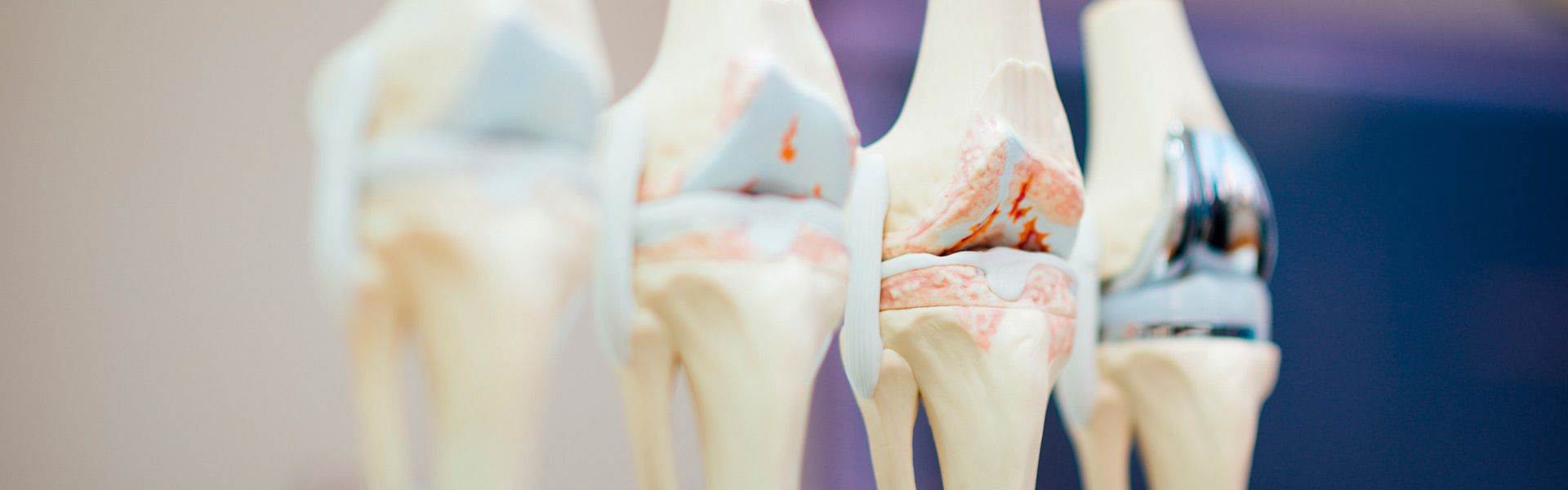 Consulta de traumatología